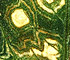 CMV on Dahlia