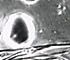 <i>Ophiobolus sp.</i>